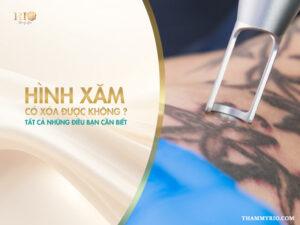 Hãy cùng Thẩm Mỹ Rio Beauty Clinic giải đáp câu hỏi hình xăm có xóa được không
