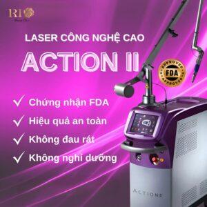 Máy Laser ND YAG SPECTRA là siêu phẩm trị nám, xóa xăm, trị chàm bớt, tàn nhang được đánh giá tốt nhất hiện nay