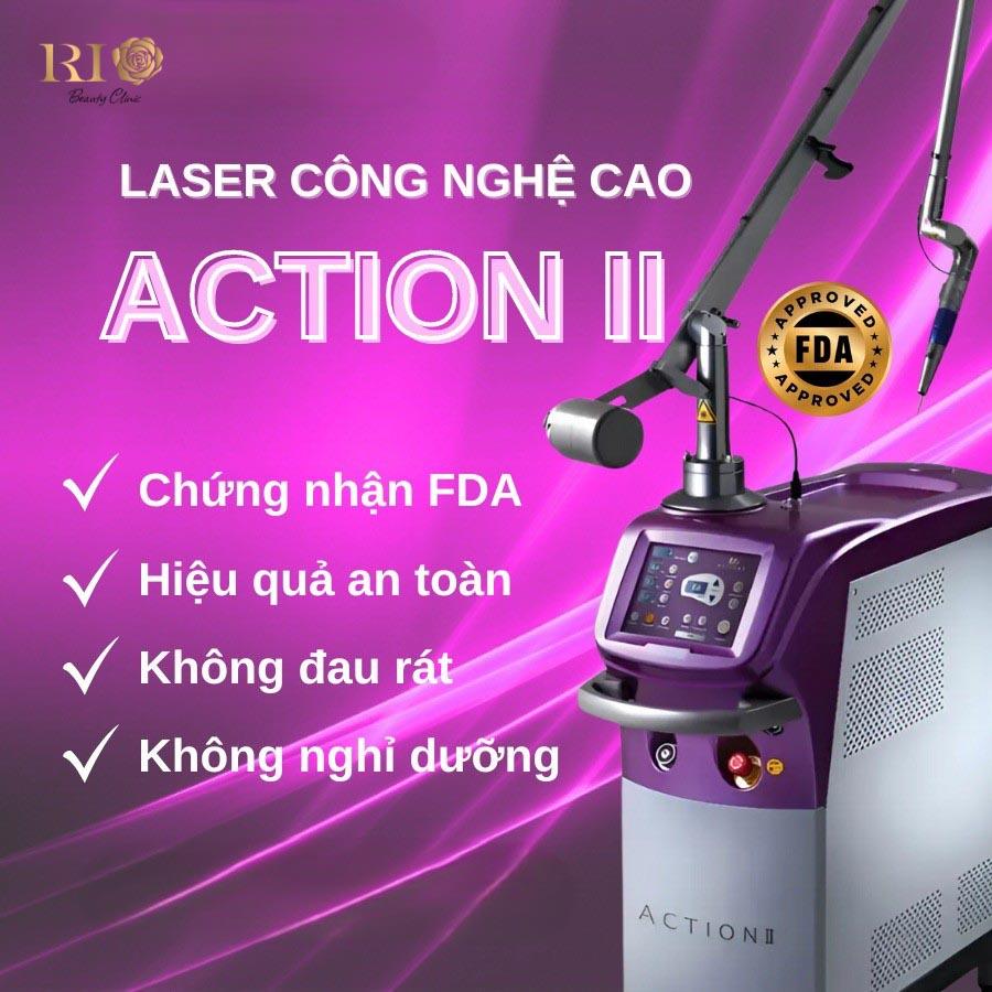 Máy laser ND YAG Spectra - Công nghệ đỉnh cao xóa xăm, trị nám 5 Máy Laser ND YAG SPECTRA là siêu phẩm trị nám, xóa xăm, trị chàm bớt, tàn nhang được đánh giá tốt nhất hiện nay