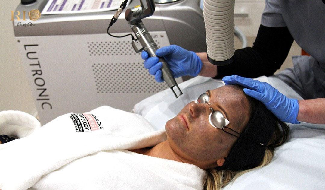 Máy laser ND YAG Spectra - Công nghệ đỉnh cao xóa xăm, trị nám 6 Với Máy Laser ND YAG SPECTRA mọi vết sắc tố như nám chàm bớt tàn nhang đều bay mất nhanh chóng