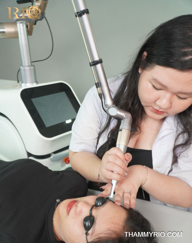 Sửa dáng lông mày đã phun hiệu quả, an toàn cho mọi dáng mày 6 Sửa dáng lông mày đã phun bằng laser: Loại bỏ triệt để màu trổ xanh đỏ và phần bị lệch