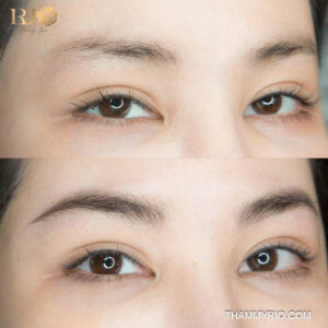 Sửa dáng lông mày đã phun lấy lại vẻ trẻ trung