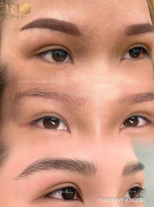 Lông mày được cứu chữa toàn diện: Xóa các vết loang lổ, sau đó điêu khắc sợi mới tạo độ dày và sắc nét tự nhiên.