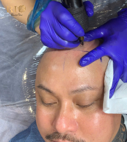 Quy trình thực hiện dịch vụ xăm chân tóc chuyên nghiệp tại Rio Beauty Clinic.