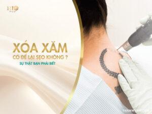 Thẩm Mỹ Rio Beauty Clinic giải đáp câu hỏi xóa xăm có để lại sẹo không