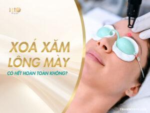 Xóa xăm lông mày có hết hoàn toàn không?