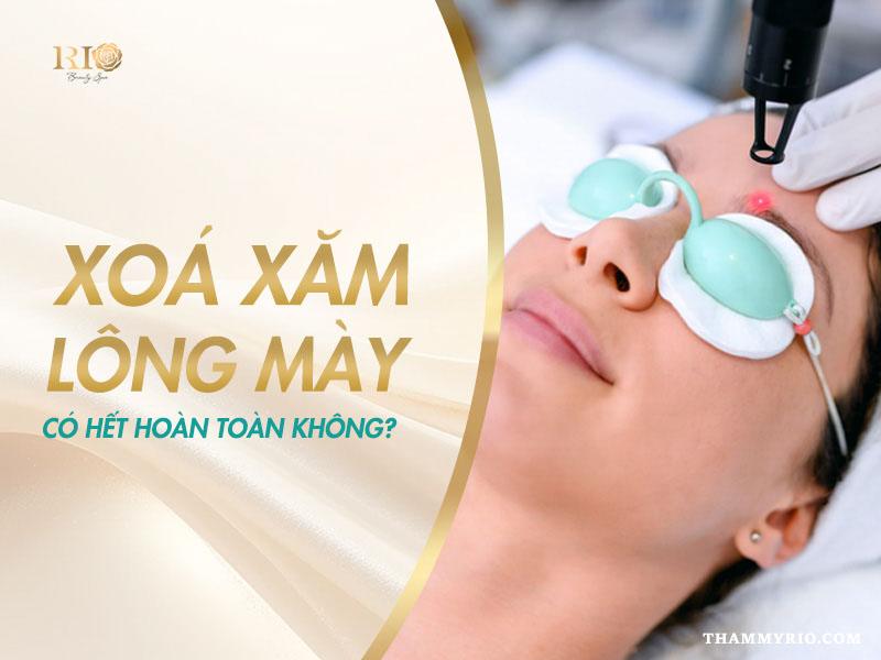 Xóa xăm lông mày có hết hoàn toàn không?