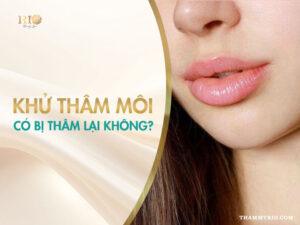 khử thâm môi có bị thâm lại không
