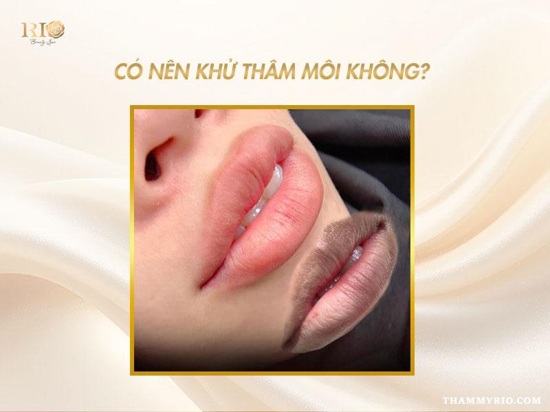 Khử thâm môi có bị thâm lại không? Nên khử thâm môi không? 4 Có nên khử thâm môi có bị thâm lại không