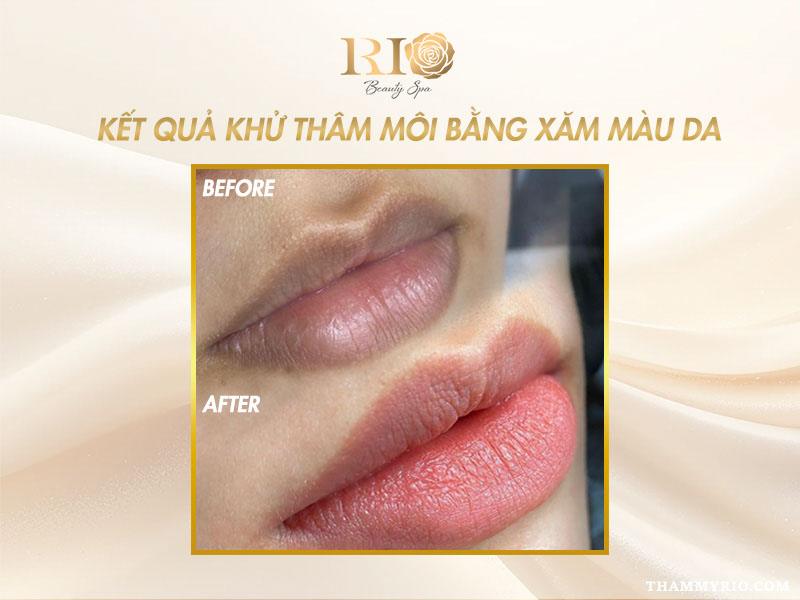Khử thâm môi giá bao nhiêu? Cập nhật bảng giá khử thâm môi mới 5 Hình ảnh khử thâm môi giá bao nhiêu bằng kỹ thuật xăm màu da che phủ thâm sạm.