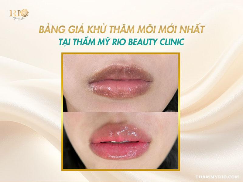 Khử thâm môi giá bao nhiêu? Cập nhật bảng giá khử thâm môi mới 7 Bảng giá khử thâm môi giá bao nhiêu cập nhật mới nhất tại Thẩm Mỹ Rio Beauty Clinic.
