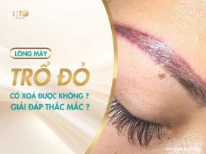 Lông mày trổ đỏ có xóa được không? Giải đáp chi tiết