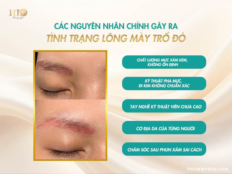 Lông mày trổ đỏ có xóa được không? Giải đáp chi tiết 2 Infographic nguyên nhân khiến lông mày trổ đỏ có xóa được không – do mực kém chất lượng, tay nghề yếu và cơ địa.