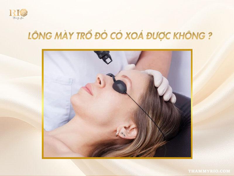 Lông mày trổ đỏ có xóa được không? Giải đáp chi tiết 3 Công nghệ laser hiện đại giúp xử lý lông mày trổ đỏ có xóa được không một cách an toàn và không đau.