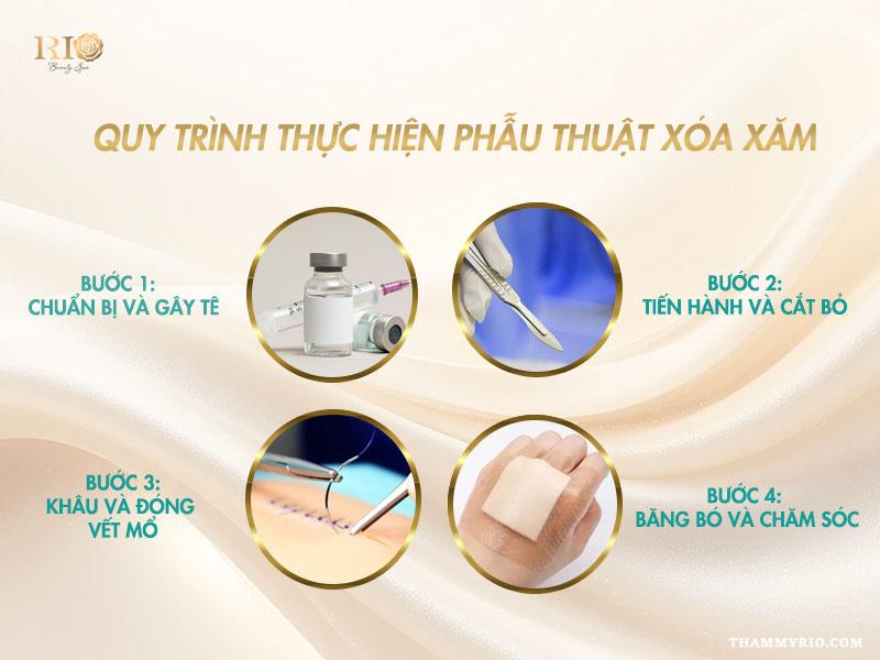 Phẫu thuật cắt bỏ hình xăm là gì? Có nên lựa chọn phương pháp này? 3 Quy trình 4 bước thực hiện phẫu thuật cắt bỏ hình xăm an toàn.