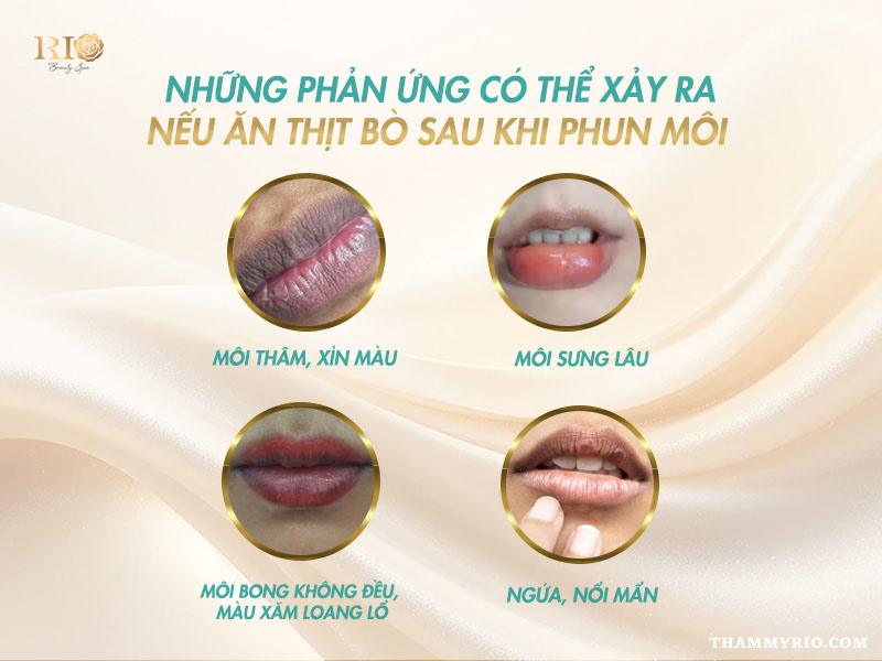 Phun môi 1 tháng ăn thịt bò được không? Lỡ ăn có sao không? 5 Những phản ứng có thể xảy ra khi phun môi 1 tháng ăn thịt bò được không
