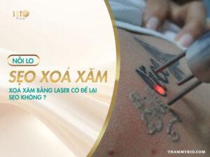 Sẹo xóa xăm. Xóa xăm bằng laser có để lại sẹo không?