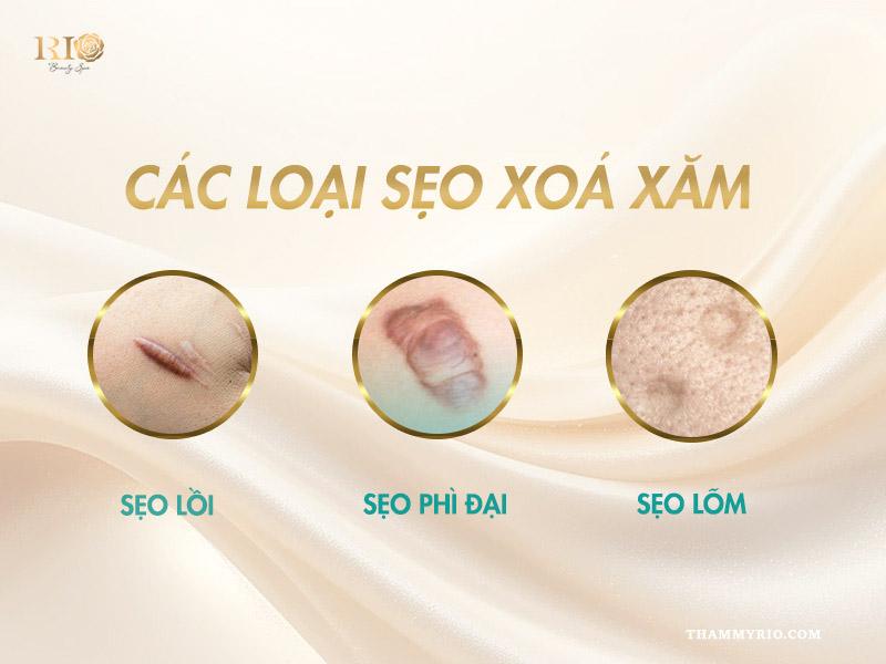 Nỗi lo sẹo xóa xăm - Xóa xăm bằng laser có để lại sẹo không? 2 Hình ảnh minh họa các loại sẹo xóa xăm thường gặp: sẹo lồi, sẹo lõm và sẹo thâm