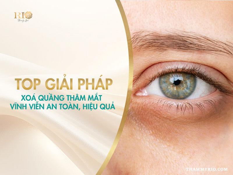 Giải pháp xóa quầng thâm mắt vĩnh viễn an toàn và hiệu quả tại Thẩm Mỹ Rio Beauty Clinic