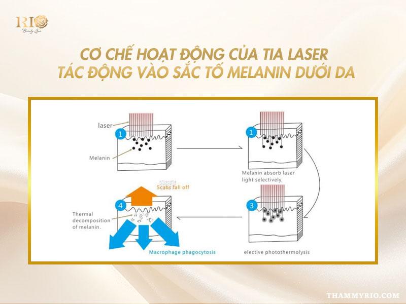 Top giải pháp xóa quầng thâm mắt vĩnh viễn an toàn, hiệu quả 5 Cơ chế hoạt động của Laser trong xóa quầng thâm mắt