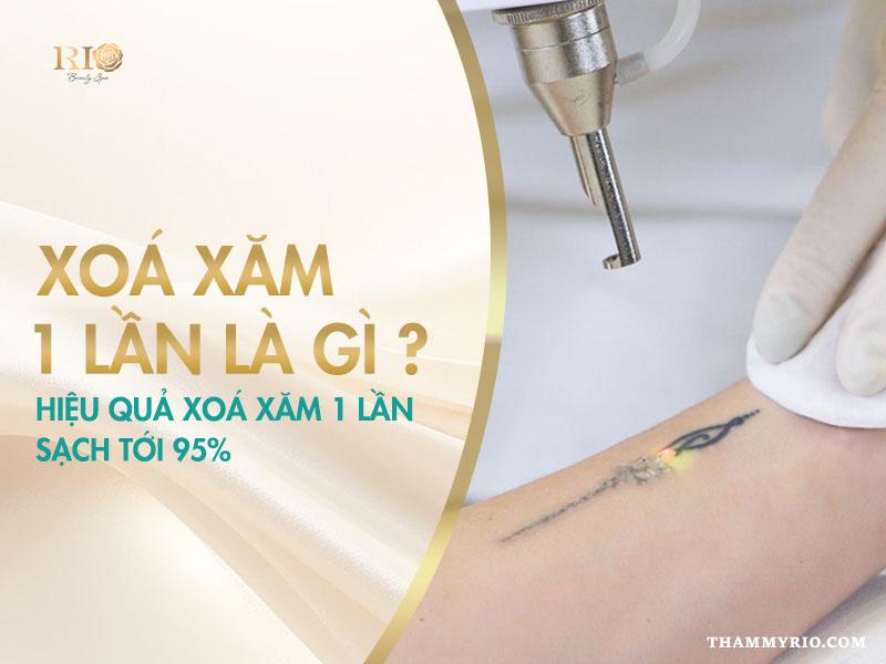 Xóa xăm 1 lần