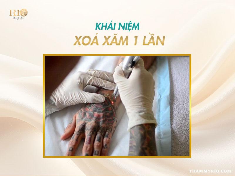 Xóa xăm 1 lần là gì? Hiệu quả xóa hình xăm 1 lần sạch tới 95% 2 Giới thiệu xóa xăm 1 lần