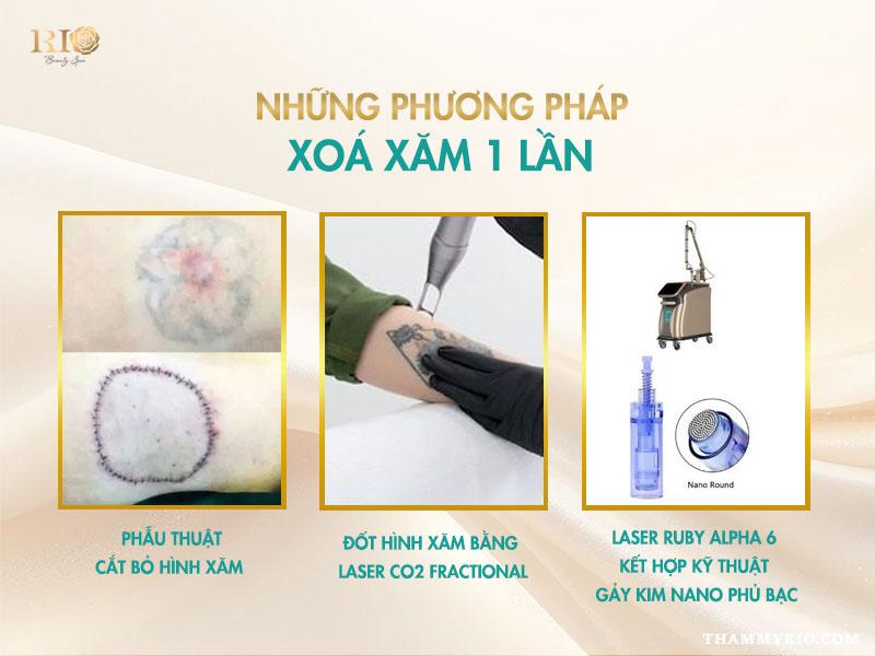 Xóa xăm 1 lần là gì? Hiệu quả xóa hình xăm 1 lần sạch tới 95% 4 Các phương pháp xóa xăm 1 lần gồm phẫu thuật cắt bỏ hình xăm, Laser CO2 Fractional và Laser Ruby Alpha6 kết hợp gảy kim nano phủ bạc.