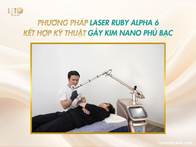 Xóa xăm 1 lần là gì? Hiệu quả xóa hình xăm 1 lần sạch tới 95% 5 Chuyên gia Laser Thẩm Mỹ Rio thực hiện xóa xăm 1 lần bằng công nghệ Laser Ruby Alpha6.