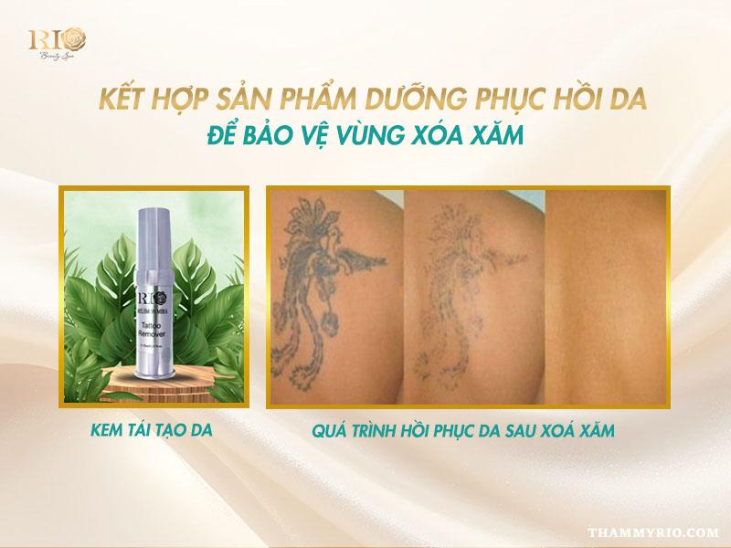 Nguyên nhân xóa xăm bị bọng nước và hướng dẫn cách xử lý 6 Kem dưỡng phục hồi hỗ trợ làm dịu vùng da xóa xăm bị bọng nước