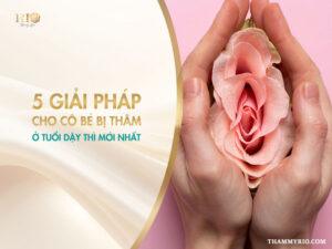 5 giải pháp cho cô bé bị thâm ở tuổi dậy thì mới nhất