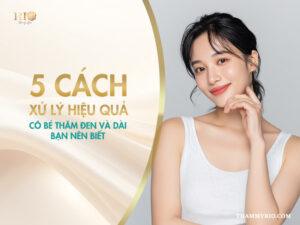 5 cách xử lý cô bé thâm đen và dài hiệu quả bạn nên biết