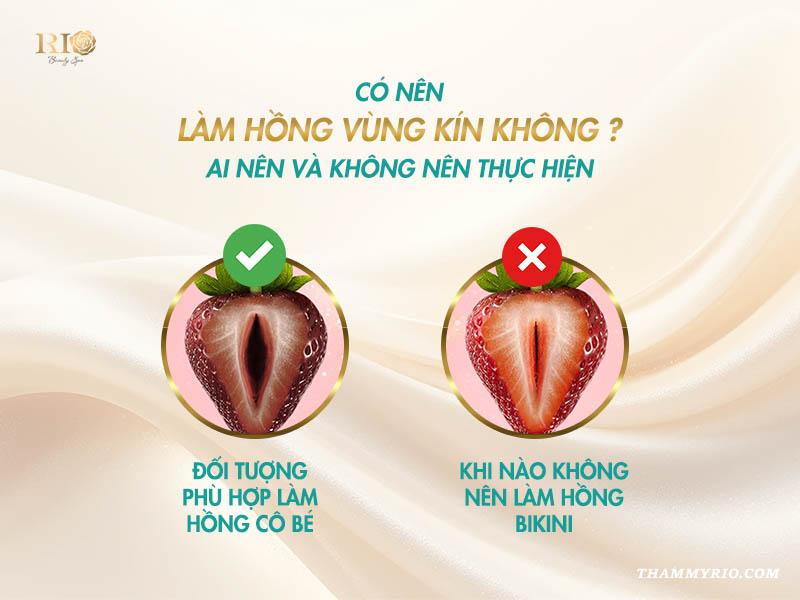 Có nên làm hồng vùng kín không? - Giải đáp từ A - Z 4 Có nên làm hồng vùng kín không?