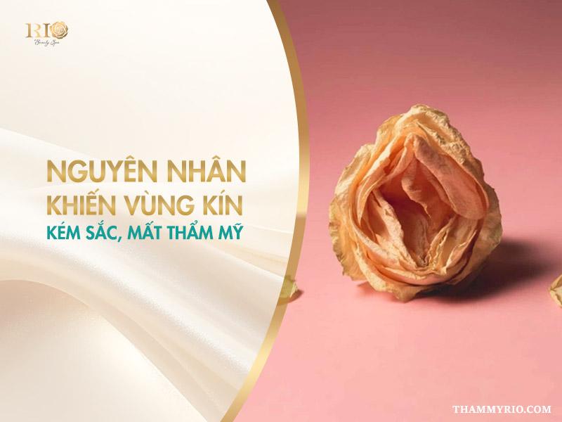 Top các cách làm vùng kín đẹp, tự tin và hồng hào năm 2025 4 Các nguyên nhân khiến vùng kín đẹp bị ảnh hưởng