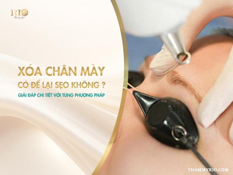 Xóa chân mày có để lại sẹo không? Sự thật mà ít ai biết 4 Với sự phát triển của ngành thẩm mỹ, việc xóa mực xăm an toàn, không để lại sẹo là hoàn toàn khả thi, miễn là bạn lựa chọn đúng công nghệ và một địa chỉ thực hiện uy tín.