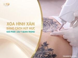 Khám phá ưu và nhược điểm của các phương pháp xóa hình xăm bằng cách hút mực.