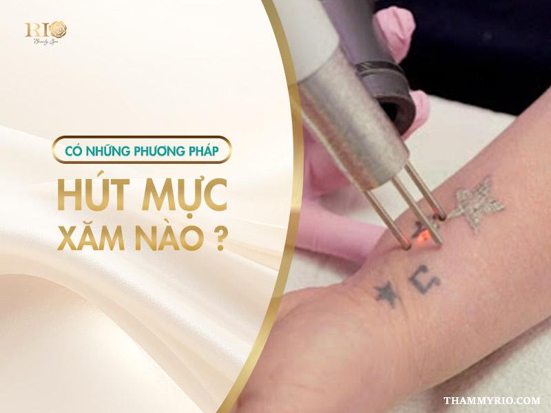 Xóa hình xăm bằng cách hút mực: Giải pháp, Lưu ý quan trọng 3 Trên thị trường hiện nay, khi nói về hút mực xóa xăm, chúng ta có thể phân loại thành 3 nhóm chính. Mỗi nhóm sở hữu cơ chế, ưu nhược điểm, độ an toàn và chi phí riêng, đáp ứng các nhu cầu và tình trạng hình xăm đa dạng của mỗi người.