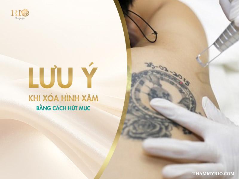Xóa hình xăm bằng cách hút mực: Giải pháp, Lưu ý quan trọng 4 Dù bạn chọn phương pháp xóa hình xăm bằng cách hút mực nào, việc ghi nhớ những điều sau sẽ giúp bạn đạt được kết quả tốt nhất và phòng tránh rủi ro.