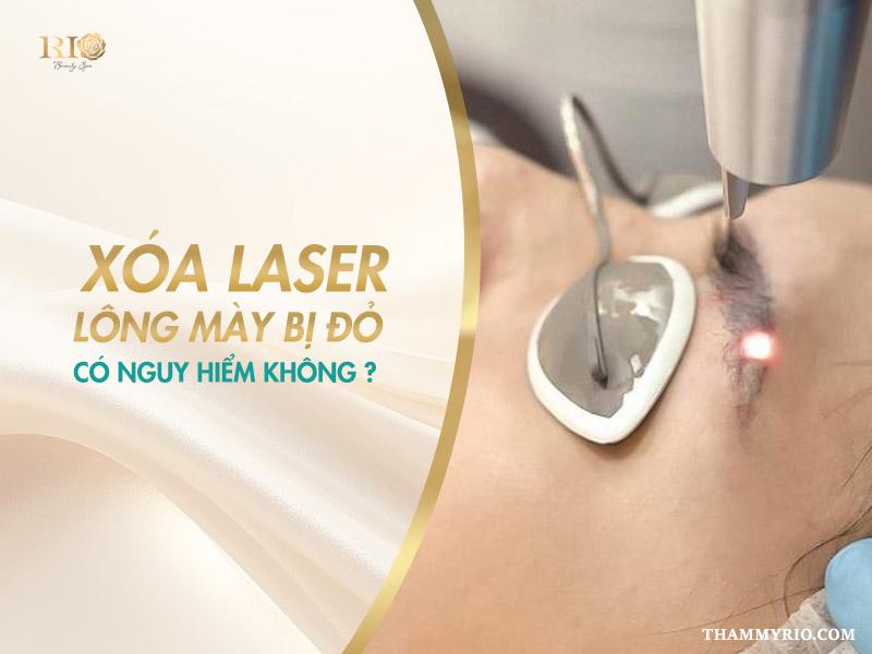 Xóa laser lông mày bị đỏ: Lý do và hướng khắc phục an toàn 3 Không phải mọi trường hợp xóa Laser lông mày bị đỏ đều nguy hiểm. Điều cốt lõi là bạn phải phân biệt được đâu là phản ứng sinh lý bình thường của da và đâu là dấu hiệu cảnh báo viêm nhiễm cần can thiệp y tế.