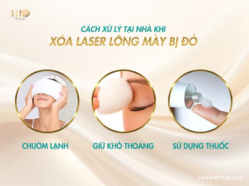 Xóa laser lông mày bị đỏ: Lý do và hướng khắc phục an toàn 5 Trong đa số trường hợp xóa Laser lông mày bị đỏ chỉ là phản ứng sinh lý lành tính. Bạn hoàn toàn có thể áp dụng các phương pháp đơn giản sau đây để làm dịu da và thúc đẩy quá trình hồi phục.