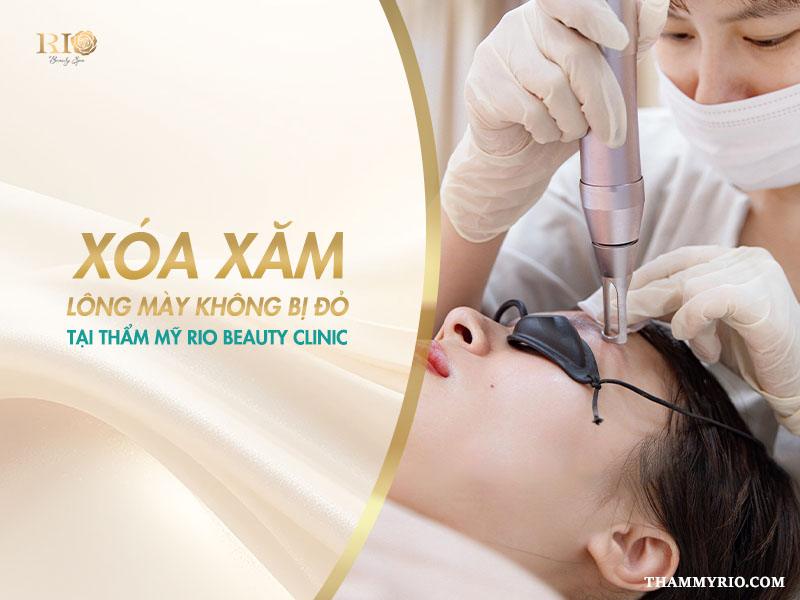 Xóa laser lông mày bị đỏ: Lý do và hướng khắc phục an toàn 6 Thay vì phải lo lắng xử lý các rủi ro, hãy lựa chọn Thẩm Mỹ Rio Beauty Clinic với công nghệ xóa xăm Laser hiện đại, cam kết hiệu quả và giảm thiểu tối đa tình trạng xóa Laser lông mày bị đỏ.