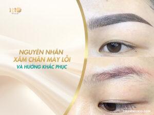 Xăm chân mày lỗi