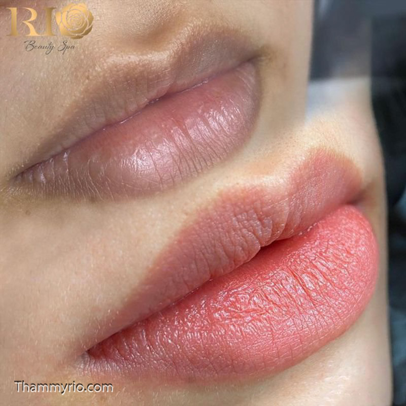 Giá xăm môi khử thâm bằng phun xăm tone màu da tự nhiên tại Rio Beauty Clinic