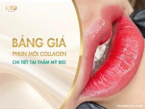bảng giá phun môi collagen