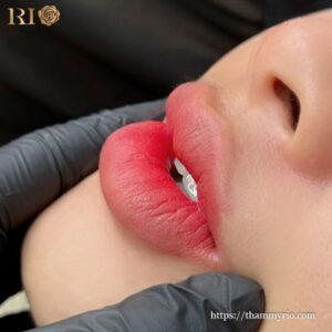 Hình ảnh môi collagen tone đỏ quyến rũ theo bảng giá phun môi collagen