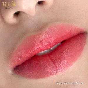 Kết quả môi collagen đẹp sau khi tham khảo bảng giá phun môi collagen Rio