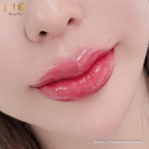 Đôi môi hồng tươi rạng rỡ từ dịch vụ bảng giá phun môi collagen ưu đãi