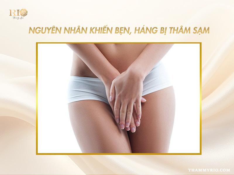 Cách trị thâm bẹn tại nhà có tốt không? Giải pháp thay thế 2 Nguyên nhân phổ biến gây thâm sạm vùng bẹn – cách trị thâm bẹn hiệu quả cần bắt đầu từ gốc rễ