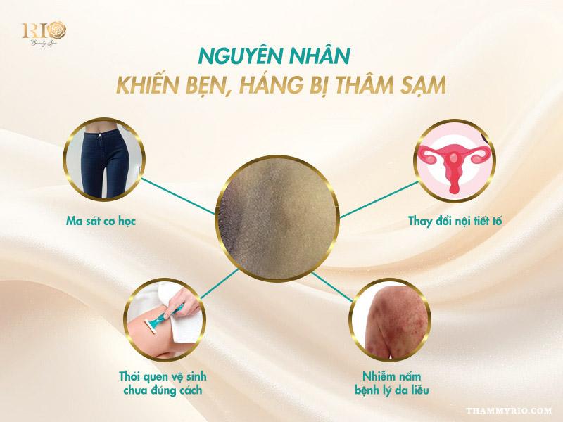 Cách trị thâm bẹn tại nhà có tốt không? Giải pháp thay thế 3 Sơ đồ các nguyên nhân gây thâm bẹn và háng – cách trị thâm bẹn hiệu quả tại nhà và thẩm mỹ viện