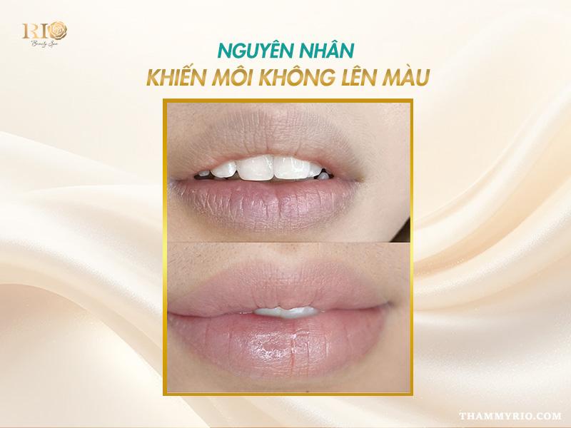 Nhận biết dấu hiệu phun môi thành công và không lên màu 6 nguyên nhân môi không lên màu sau phun xăm.