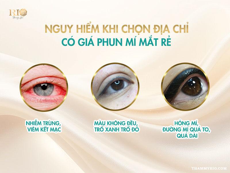 Giá phun mí mắt mới nhất - Ưu đãi phun mí mở tròng hot! 4 Nguy hiểm tiềm ẩn khi lựa chọn dịch vụ giá phun mí mắt rẻ kém chất lượng.